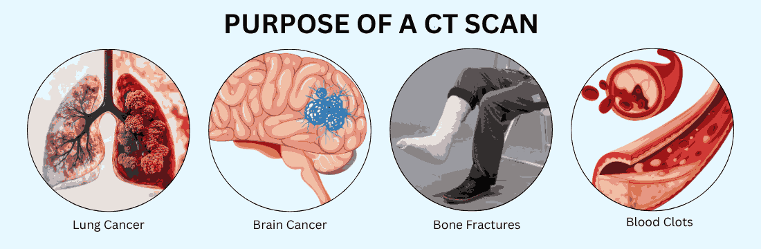 Purpose of a CT Scan